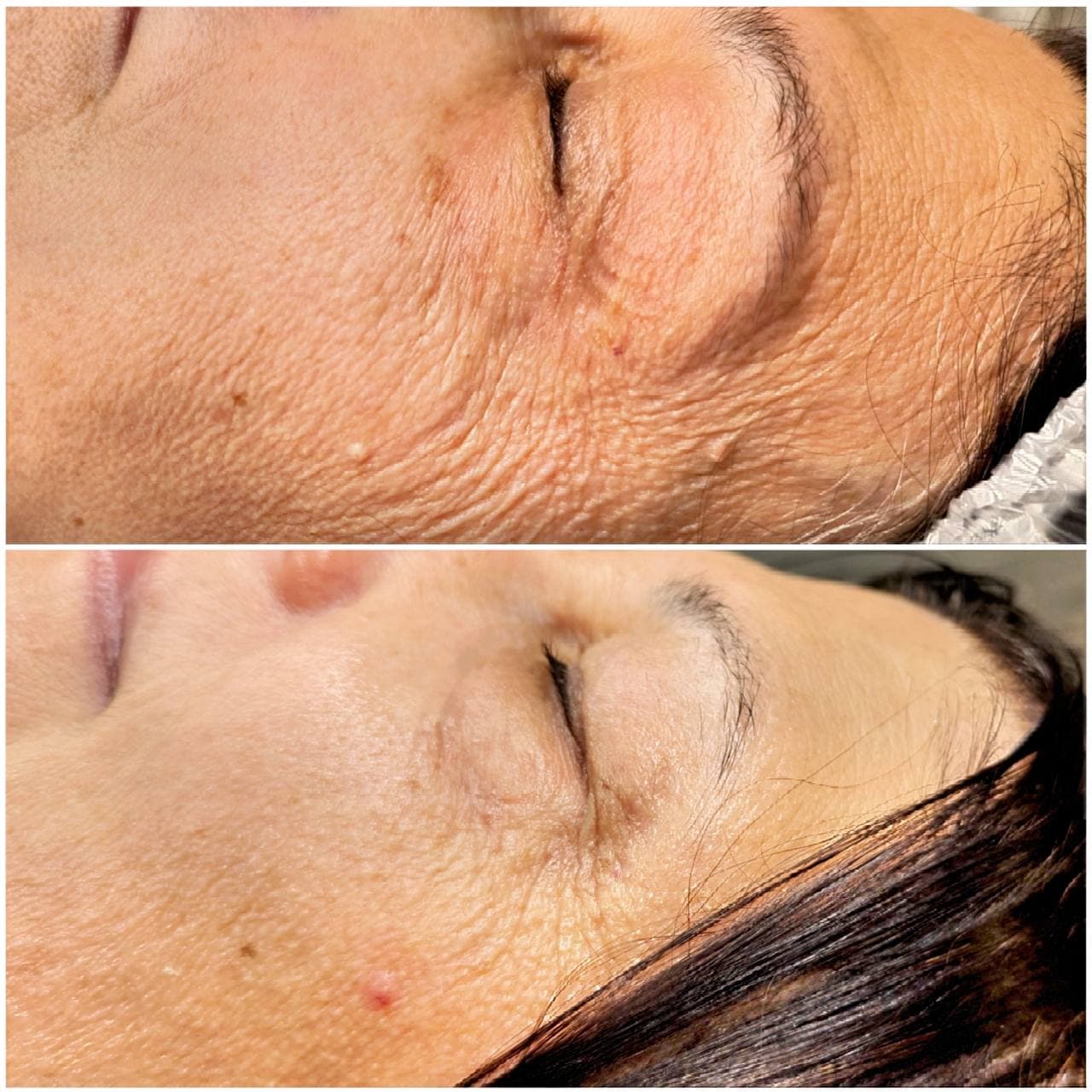 Polynucleotides at Mona Aesthetics